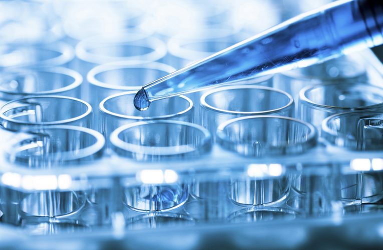 Sclerosi multipla e terapia STEMS: scoperta proteina-farmaco rilasciata dalle cellule staminali