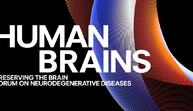 HUMAN BRAINS