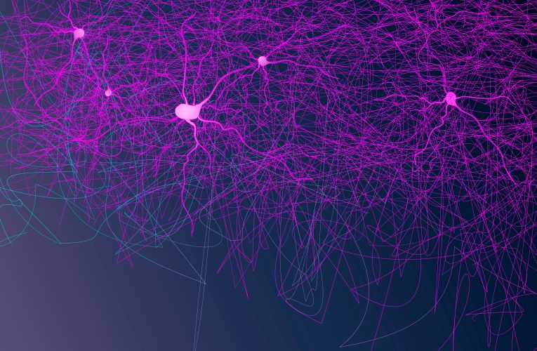 NEUROFILAMENTI: UN NUOVO BIOMARCATORE PER IL MONITORAGGIO DELLA MALATTIA