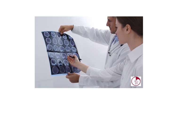 Aggiornamenti dalla ricerca sulla sclerosi multipla: prevenire il danno immuno-mediato e sostenere i meccanismi di riparazione